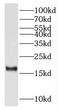 Ribosomal Protein S15 antibody, FNab07461, FineTest, Western Blot image 