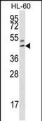 Homeobox protein Hox-B3 antibody, PA5-48399, Invitrogen Antibodies, Western Blot image 