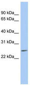 LY6/PLAUR Domain Containing 5 antibody, TA333392, Origene, Western Blot image 