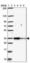 Mitochondrial import receptor subunit TOM34 antibody, PA5-63361, Invitrogen Antibodies, Western Blot image 