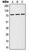 Solute Carrier Family 9 Member A6 antibody, LS-C353260, Lifespan Biosciences, Western Blot image 