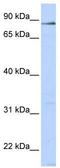 L3MBTL Histone Methyl-Lysine Binding Protein 4 antibody, TA341512, Origene, Western Blot image 