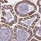 Kelch-like protein 3 antibody, HPA051291, Atlas Antibodies, Immunohistochemistry paraffin image 