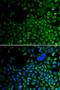 Histone Deacetylase 2 antibody, LS-C331881, Lifespan Biosciences, Immunofluorescence image 