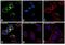 ERBB2 antibody, MA1-35720, Invitrogen Antibodies, Immunofluorescence image 