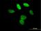 Lethal(3)malignant brain tumor-like protein 3 antibody, H00084456-B01P, Novus Biologicals, Immunofluorescence image 