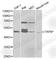 TAP Binding Protein antibody, A1968, ABclonal Technology, Western Blot image 