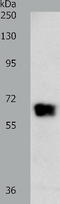 G Protein-Coupled Receptor Kinase 4 antibody, TA323501, Origene, Western Blot image 