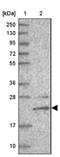 TBC/LysM-Associated Domain Containing 2 antibody, NBP2-14595, Novus Biologicals, Western Blot image 