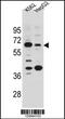 Solute Carrier Family 9 Member B1 antibody, 55-692, ProSci, Western Blot image 