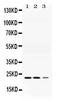 Adenylate Kinase 1 antibody, PA5-78748, Invitrogen Antibodies, Western Blot image 
