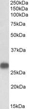 Dual Specificity Phosphatase 6 antibody, 43-212, ProSci, Western Blot image 