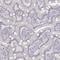 Keratin 72 antibody, NBP2-56495, Novus Biologicals, Immunocytochemistry image 