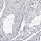 Arginine-Fifty Homeobox antibody, NBP2-14307, Novus Biologicals, Immunohistochemistry paraffin image 