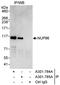 Nuclear pore complex protein Nup98-Nup96 antibody, A301-785A, Bethyl Labs, Immunoprecipitation image 