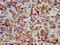 Hydroxymethylglutaryl-CoA synthase, mitochondrial antibody, CSB-PA010567LA01HU, Cusabio, Immunohistochemistry paraffin image 