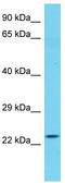 Chromosome X Open Reading Frame 56 antibody, TA331780, Origene, Western Blot image 