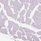 Chondrolectin antibody, HPA017282, Atlas Antibodies, Immunohistochemistry paraffin image 
