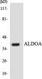 Aldolase, Fructose-Bisphosphate A antibody, EKC1669, Boster Biological Technology, Western Blot image 