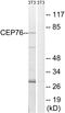 Centrosomal Protein 76 antibody, PA5-39091, Invitrogen Antibodies, Western Blot image 