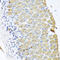 Opioid growth factor receptor antibody, 22-678, ProSci, Immunohistochemistry paraffin image 