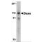 Death Domain Associated Protein antibody, TA305964, Origene, Western Blot image 
