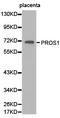 Vitamin K-dependent protein S antibody, LS-C192879, Lifespan Biosciences, Western Blot image 