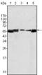 LYN Proto-Oncogene, Src Family Tyrosine Kinase antibody, NB110-60538, Novus Biologicals, Western Blot image 
