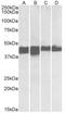 Creatine kinase M-type antibody, AP32737PU-N, Origene, Western Blot image 
