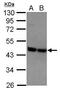 Purinergic Receptor P2Y2 antibody, PA5-30113, Invitrogen Antibodies, Western Blot image 