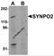Synaptopodin 2 antibody, 6051, ProSci, Western Blot image 
