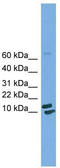 Peptidyl-prolyl cis-trans isomerase H antibody, TA340101, Origene, Western Blot image 