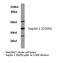 LARP antibody, LS-C176826, Lifespan Biosciences, Western Blot image 