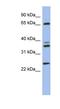 ATPase H+ Transporting V1 Subunit A antibody, NBP1-55212, Novus Biologicals, Western Blot image 