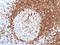 CD79a antibody, orb388956, Biorbyt, Immunohistochemistry paraffin image 