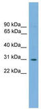 ETS-related transcription factor Elf-5 antibody, TA342256, Origene, Western Blot image 
