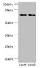 Melanoma-associated antigen C3 antibody, LS-C378187, Lifespan Biosciences, Western Blot image 