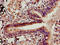 Claudin 5 antibody, LS-C671517, Lifespan Biosciences, Immunohistochemistry paraffin image 