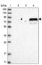 SOGA Family Member 3 antibody, PA5-57254, Invitrogen Antibodies, Western Blot image 