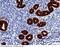 Epithelial Cell Adhesion Molecule antibody, 50591-R002, Sino Biological, Immunohistochemistry frozen image 