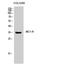 Melanocortin 1 Receptor antibody, STJ94038, St John