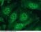 Hypoxia-inducible factor 1-alpha antibody, 11977-R004, Sino Biological, Immunohistochemistry paraffin image 