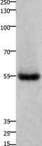HNF1 Homeobox A antibody, TA321150, Origene, Western Blot image 