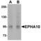 EPH Receptor A10 antibody, A09787, Boster Biological Technology, Western Blot image 