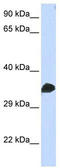 Cyclin Dependent Kinase 1 antibody, TA330324, Origene, Western Blot image 