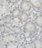 Sirtuin 3 antibody, FNab07881, FineTest, Immunohistochemistry paraffin image 