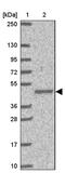 SLC44A4 antibody, PA5-62934, Invitrogen Antibodies, Western Blot image 