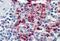CYSLTR2 antibody, MBS247163, MyBioSource, Immunohistochemistry paraffin image 