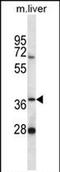 PNKD Metallo-Beta-Lactamase Domain Containing antibody, PA5-71728, Invitrogen Antibodies, Western Blot image 
