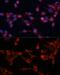 hPrt1 antibody, GTX64714, GeneTex, Immunocytochemistry image 
